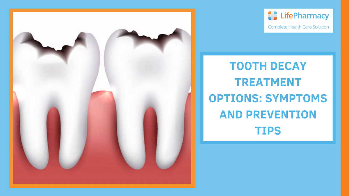 Tooth Decay Treatment Options: Symptoms and Prevention Tips | Medium