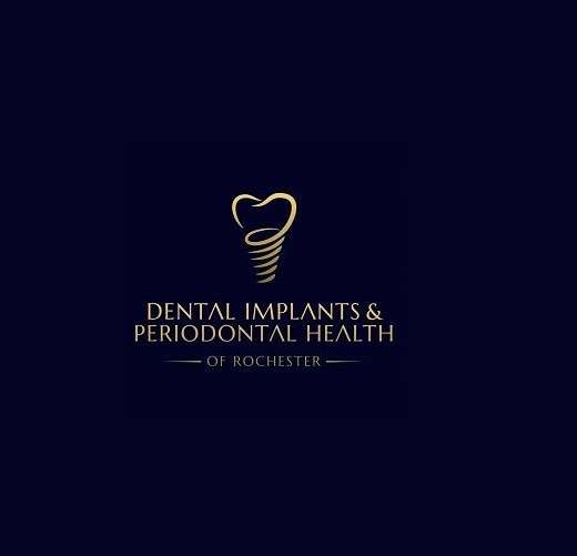 DENTAL IMPLANTS And PERIODONTAL HEALTH